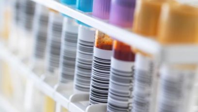 Non-invasive retinale markører ved diabetisk retinopati – fra forskning til evidensbaseret behandling