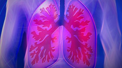 Pulmonal arteriel hypertension