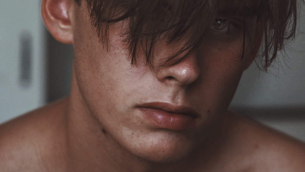 Temporal variation af Staphyloccocus aureus hos patienter med atopisk dermatitis