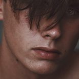 Temporal variation af Staphyloccocus aureus hos patienter med atopisk dermatitis