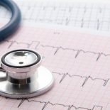 Hjerte EKG