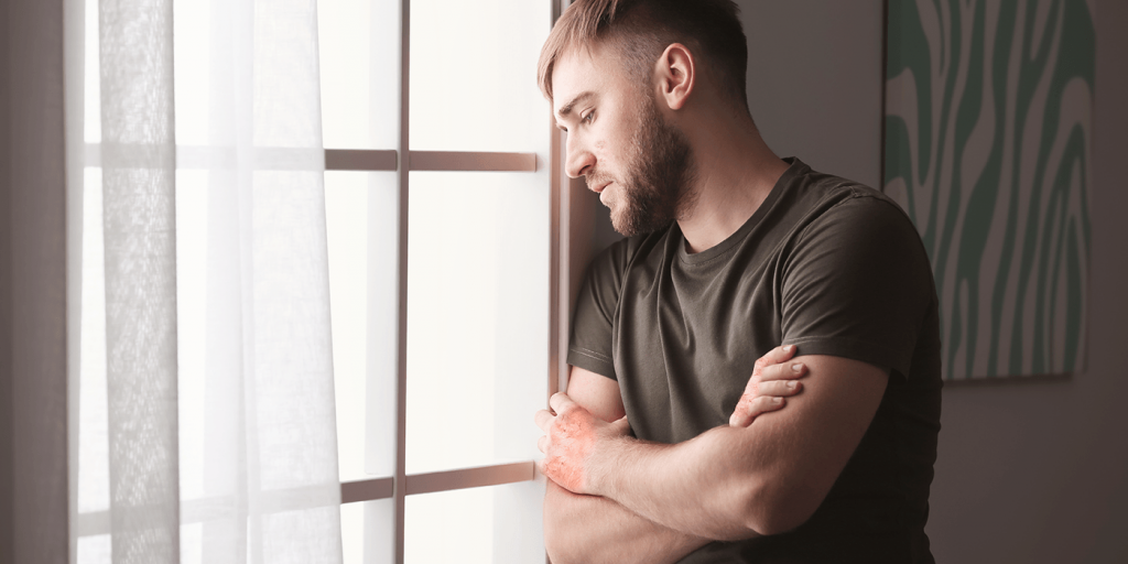 Atopisk Dermatitis Depression