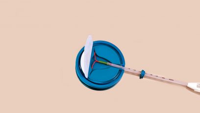 intrauterine device for women