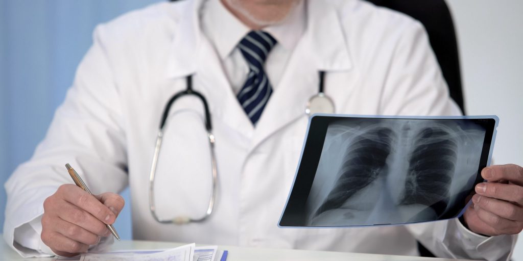 Læge ser på røntgenfotografi af patient