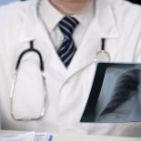 Læge ser på røntgenfotografi af patient