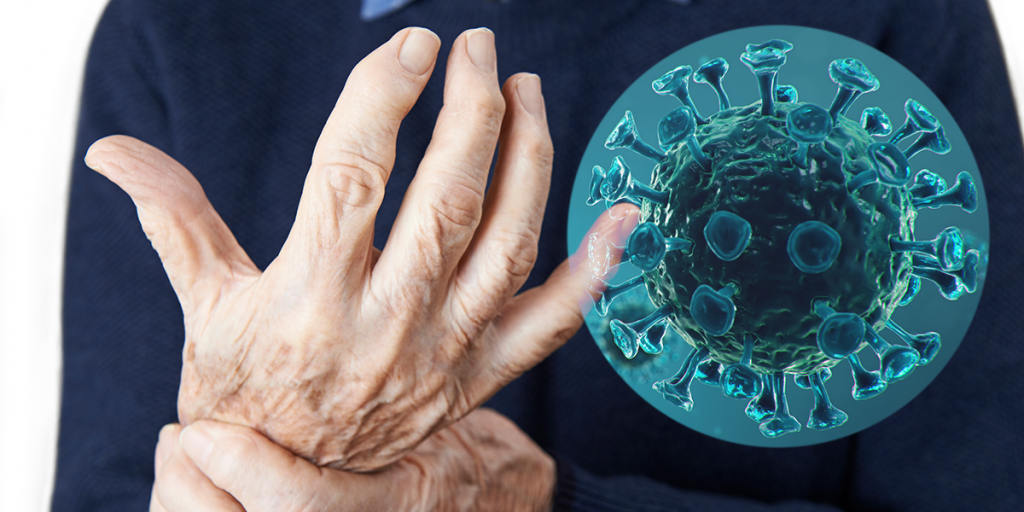 Man Suffering With Arthritis, covid-19