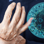 Man Suffering With Arthritis, covid-19